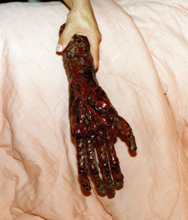 Painted clay severed arm